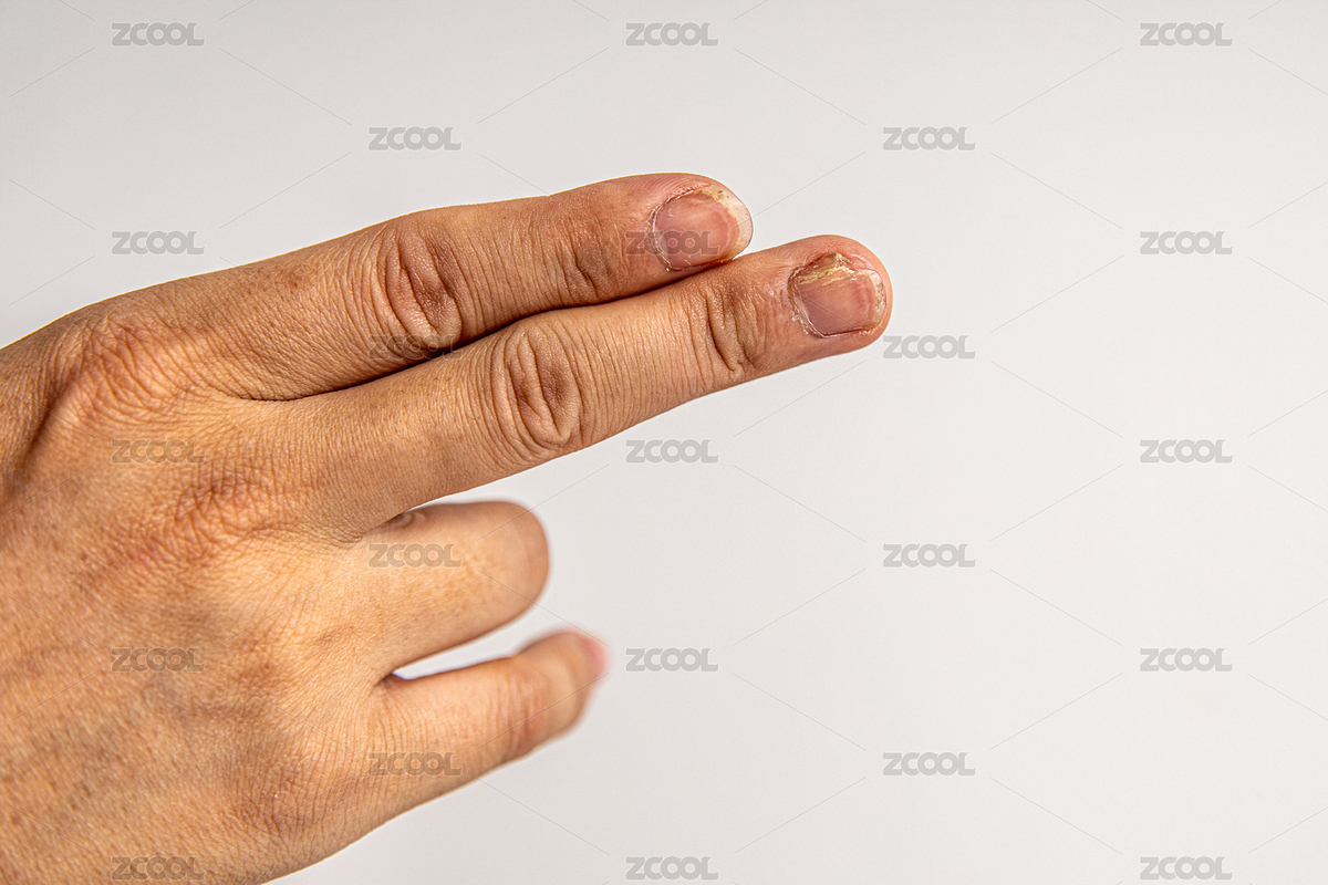 破裂的指甲（主預(yù)覽-4291185） - 未分類 - 站酷設(shè)計(jì)師Sam_Tse原創(chuàng)素材 - 站酷ZCOOL