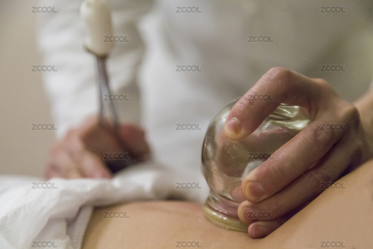 在背部進(jìn)行傳統(tǒng)中醫(yī)拔火罐療法（主預(yù)覽-4919105） - 未分類 - 站酷設(shè)計(jì)師蔚藍(lán)的白日夢(mèng)原創(chuàng)素材 - 站酷ZCOOL