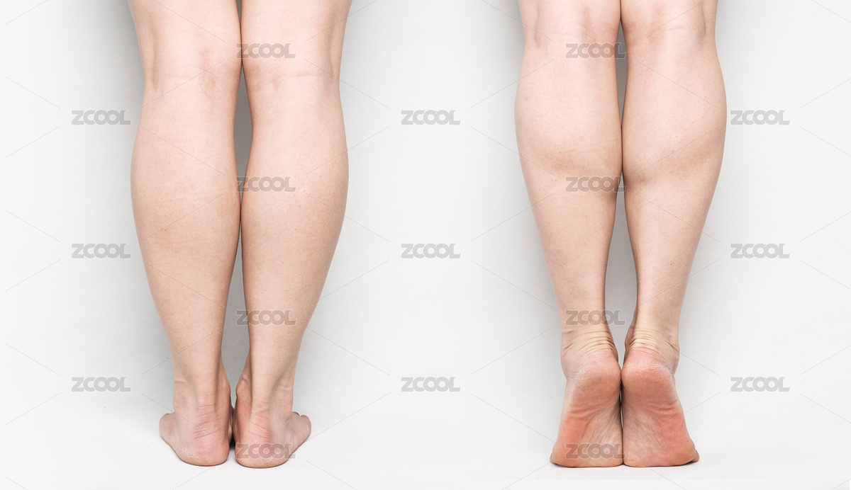 肌肉型小腿站姿和踮腳背面對(duì)比（主預(yù)覽-3513512） - 未分類 - 站酷設(shè)計(jì)師Anciens原創(chuàng)素材 - 站酷ZCOOL