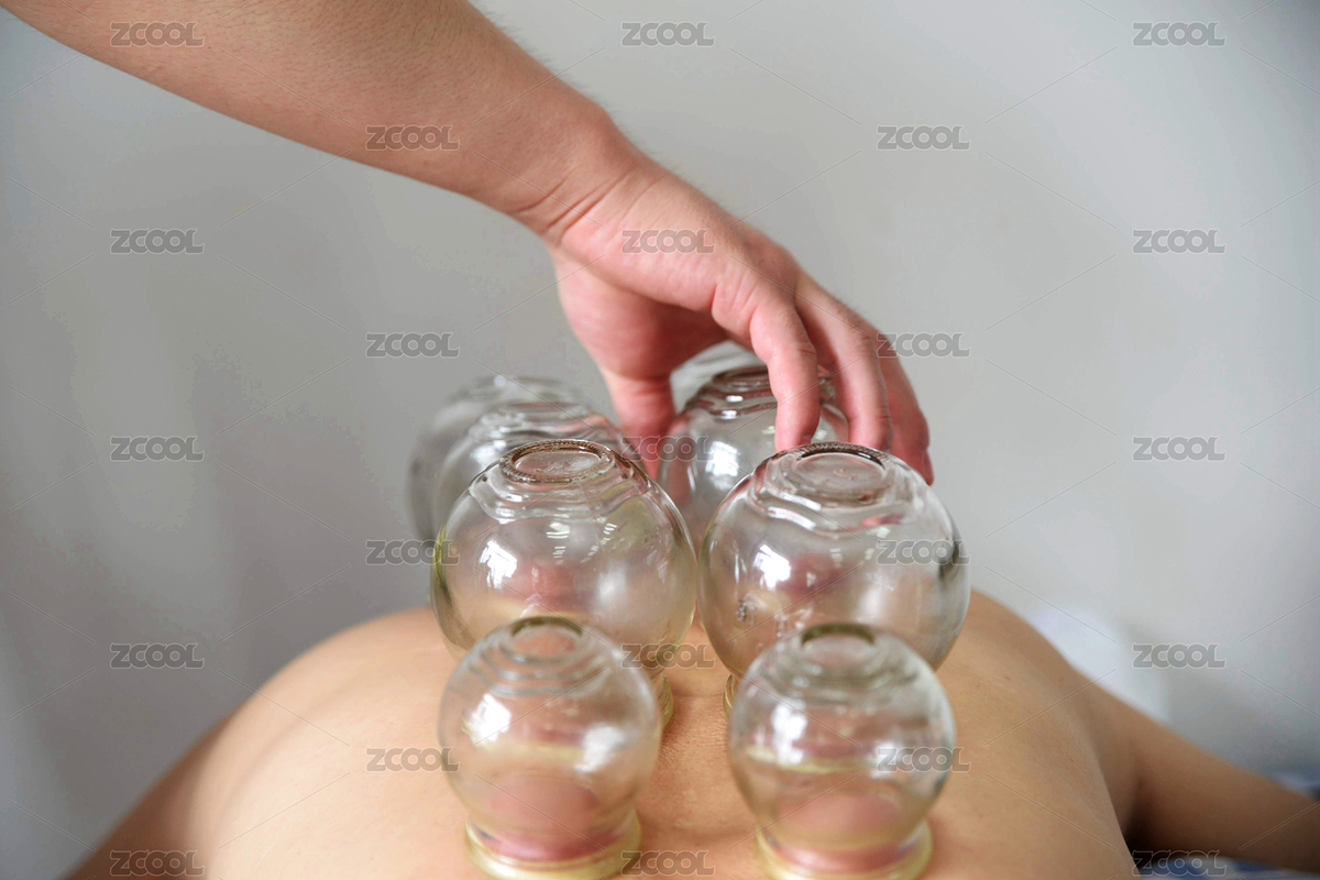 中醫(yī)拔火罐（主預(yù)覽-6341646） - 未分類 - 站酷設(shè)計師好茶婁山春原創(chuàng)素材 - 站酷ZCOOL