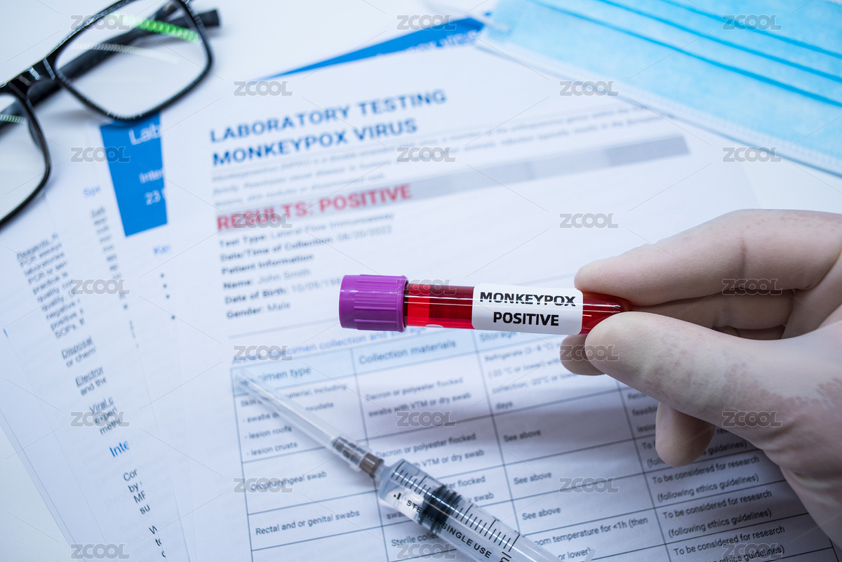 猴痘病毒血樣與檢測(cè)報(bào)告示意（主預(yù)覽-7934212） - 未分類 - 站酷設(shè)計(jì)師wutianzeri原創(chuàng)素材 - 站酷ZCOOL