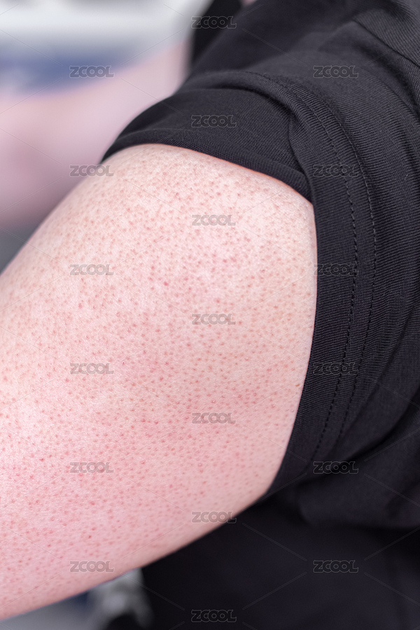 雞皮膚的腿部皮膚特寫（主預(yù)覽-1072455） - 未分類 - 站酷設(shè)計師馬勝輕原創(chuàng)素材 - 站酷ZCOOL