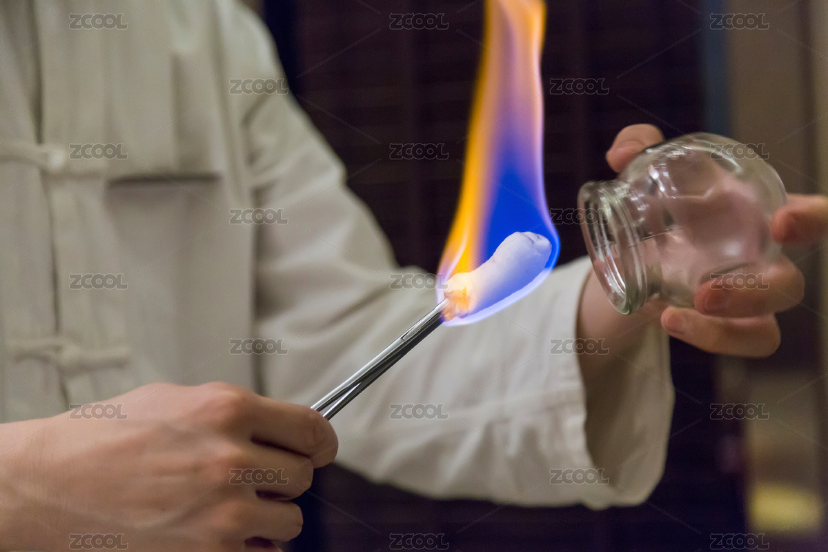 中華傳統(tǒng)醫(yī)學理療拔火罐（主預覽-3443069） - 未分類 - 站酷設計師蔚藍的白日夢原創(chuàng)素材 - 站酷ZCOOL