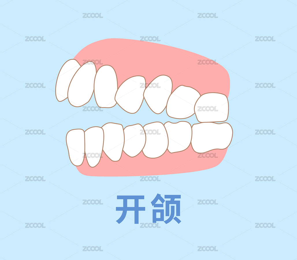 矯正牙齒 膠合插圖（主預(yù)覽-8436326） - 未分類 - 站酷設(shè)計(jì)師suma_illustrator原創(chuàng)素材 - 站酷ZCOOL