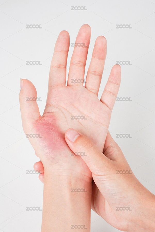 手部紅腫疼痛（主預(yù)覽-3094931） - 未分類 - 站酷設(shè)計師安147123原創(chuàng)素材 - 站酷ZCOOL