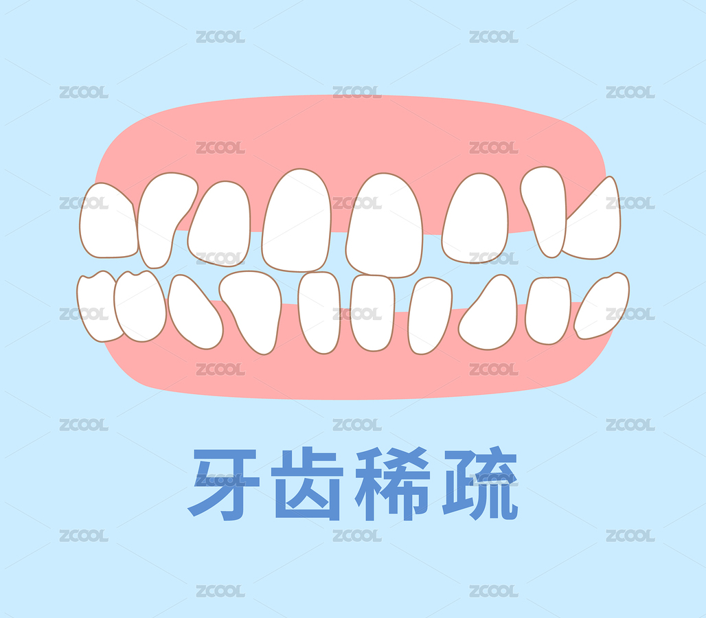 矯正牙齒 膠合插圖（主預覽-4512727） - 未分類 - 站酷設計師suma_illustrator原創(chuàng)素材 - 站酷ZCOOL