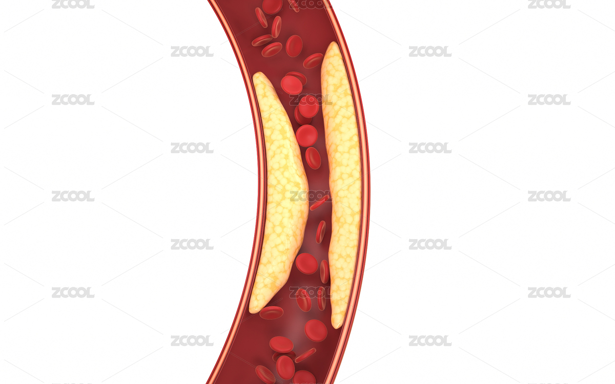 血管中的脂肪與紅細胞 3D渲染（主預覽-1879170） - 未分類 - 站酷設計師VinkFan原創(chuàng)素材 - 站酷ZCOOL